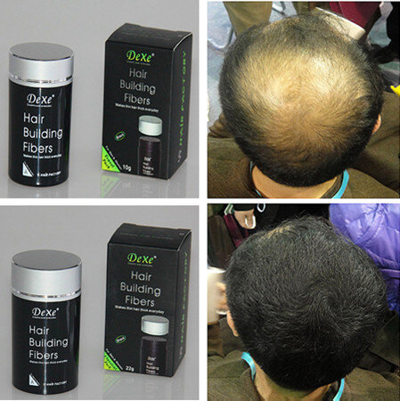 Dexe Hair Building Fibers - Saçların 5 dəqiqədə bərpası və dolğun görünüşü