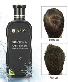 Dexe Hair Shampoo- Saç tökülməyə qarşı və saç bitirən şampun